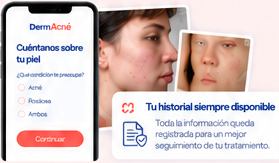 Evaluación médica, fotografías y seguimiento en DermAcné