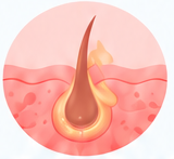seborregulacion